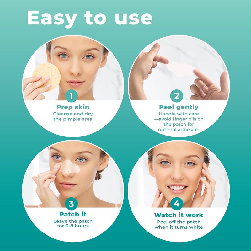 PatchRx Pimple Patches for Nose (12 Pack), Cover Nose Pimples - Hydrocolloid Acne Patches - Pimple Patch Hydrocolloid Patches & Pimple Stickers, Nose Strip, Zit Patches - Image 4